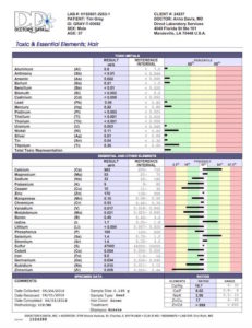 My second Doctors Data Toxic and Essential Elements Hair test (after 75 days of chelation)